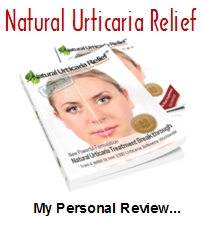 Natural Urticaria Relief Review